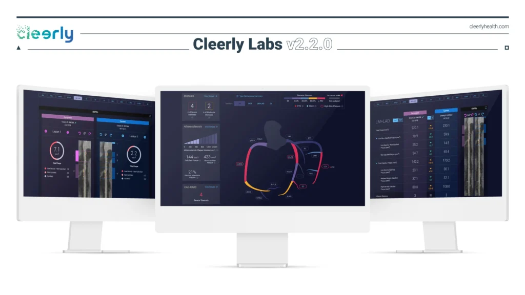 Cleerly Raises $106 Million to Revolutionize Early Detection of Heart Disease with AI